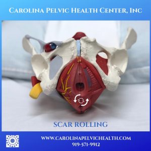 Perineal Tear Episiotomy And Scar Recovery Pt Can Help Carolina Pelvic Health