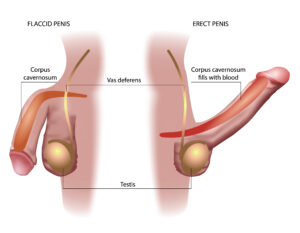 Hard Flaccid Syndrome Getting to the root of the problem